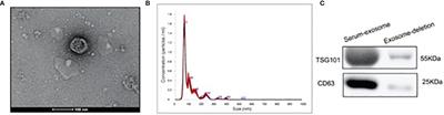 MicroRNAs in Serum Exosomes as Circulating Biomarkers for Postmenopausal Osteoporosis